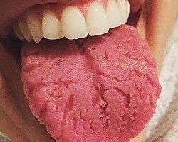 La relazione tra postura della lingua e sviluppo del palato